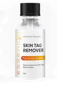 I Bought Defy Skin Tag Remover: Here is my Honest Reviews - SabiReviews